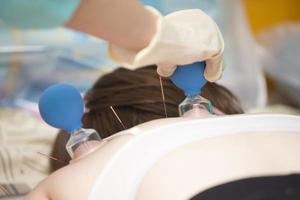 The doctor makes the patient acupuncture and vacuum massage. photo