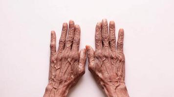 senior kvinna rörande henne hand på vit bakgrund video