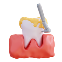 3d ilustração do limpeza tártaro com uma dental broca png