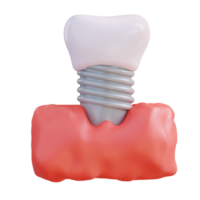 3d illustration de raccord dentiers png