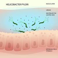 helicobacter pylori bacterias en mucosa capa de humano estómago vector