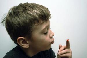 boy has injured his finger and shows a trace of a cut and blood photo