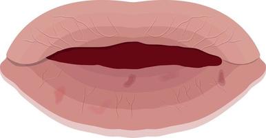 dry lips isolated on white background vector