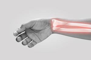 Men at higher risk of wrist fractures. Pain concept photo