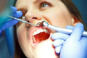 mujer consiguiendo un dental tratamiento foto