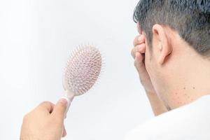 Middle-aged man shows  comb brush with loss hair and stressed about his hair loss problems photo