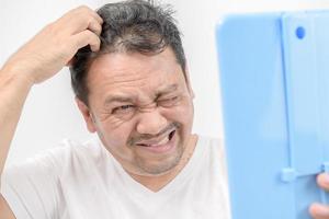 A middle-aged man shines in the mirror and uses his hands to scratch his hair on the scalp.Itchy head photo