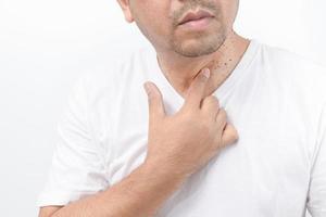 Man point to Skin Tags or Acrochordon on neck man on white background. photo