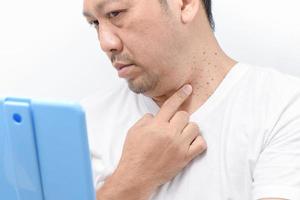 Middle-aged mam point to Skin Tags or Acrochordon on neck man photo