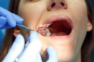 Woman getting a dental treatment photo