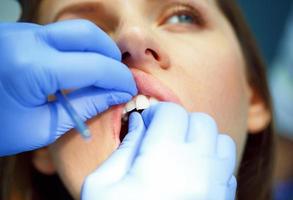 Woman getting a dental treatment photo