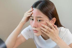 dermatología, pubertad asiático joven mujer, niña mirando dentro espejo, alergia presentación un alérgico reacción desde cosmético, rojo Mancha o erupción en rostro. belleza cuidado desde piel problema por médico tratamiento. foto