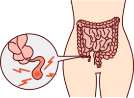 humano cuerpo con enconado apendicitis png