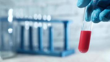 hand in blue medical gloves holding blood test tube video