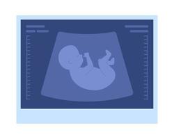 Fetal ultrasound picture semi flat color vector object. Pregnancy progress. Editable icon. Full sized element on white. Simple cartoon style spot illustration for web graphic design and animation