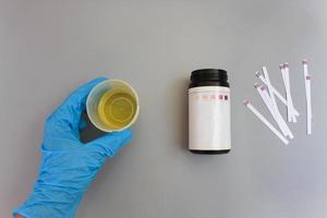 Urine test strips on a gray background. photo