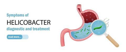 humano estómago y helicobacter pylori web bandera modelo. vector ilustración dibujos animados estilo