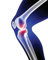 ilustración de rayos X del hueso de la pierna y la rodilla que muestra dolor. vector