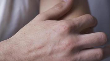 Nahansicht betont Schizophrene Hände. Nahansicht Hände von betont Schizophrene Mann. video