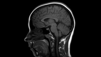 Mensch Kopf Gehirn mri Bild Filmaufnahme. Seite Aussicht Profil. Gesundheit Pflege und Medizin video