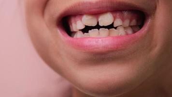 linda pequeño niña sonrisa cerca. de cerca de joven hermosa sonriente niña demostración su dientes aislado en rosado antecedentes. concepto de bueno salud en infancia. video