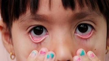 weinig meisje jeukend ogen met tranen, allergie wrijven ogen, krabben ogen terwijl spelen buitenshuis.