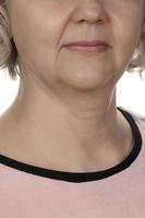 The lower part of the face of an elderly woman after fifty, with pronounced age-related changes and wrinkles. photo