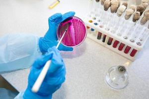 el manos de un médico laboratorio asistente en un infeccioso enfermedad laboratorio examina el muestras foto