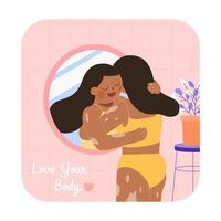 Woman with vitiligo hugging herself from the mirror. Flat illustration, concept of World Vitiligo Day and body positivity. vector