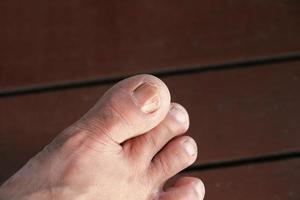 encarnado uña grande dedo del pie selectivo enfocar, roto uña del dedo del pie en madera piso con Copiar espacio foto