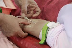 Blood donor in arm injection select focus with shallow depth of field. photo