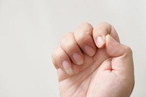 Problems with long, dirty fingernails and bacterial germs photo