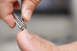 Clean and cut dirty nails to prevent germs and bacteria. photo