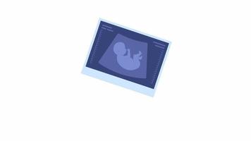 Animated ultrasound picture. Sonogram photo. First pregnancy announcement. Flat cartoon style icon 4K video footage. Color isolated object animation on white background with alpha channel transparency