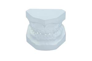 Dental plaster cast on white background photo