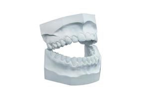 Dental plaster cast on white background photo