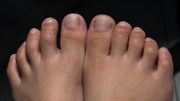 para niños uñas de los pies son desaliñado, largo y sucio. foto