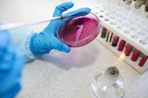 The hands of a physician laboratory assistant in an infectious disease laboratory examines the samples. photo