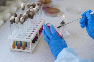 The hands of a physician laboratory assistant in an infectious disease laboratory examines the samples. photo