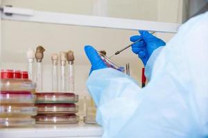 The hands of a physician laboratory assistant in an infectious disease laboratory examines the samples. photo