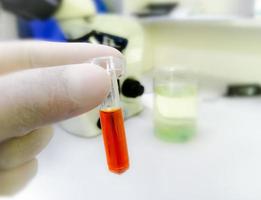 Scientist hold sample cup with icteric serum for test in laboratory. Hyperbilirubinemia, which can cause false laboratory test result. photo