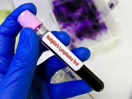 Blood sample for Hodgkin's lymphoma test, a type of cancer that affects the lymphatic system. photo