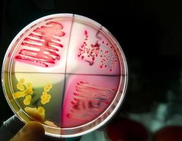 Bacteria colony on culture media plate. Bacterial culture testing. photo