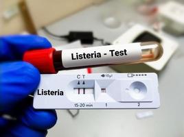 prueba tubo y rápido prueba casete para listeria bacterias prueba, diagnóstico para listeriosis foto