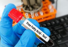 Blood Sample for free fatty acid test. photo