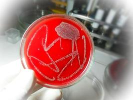 Bacteria colony on culture media plate. Bacterial culture testing. photo