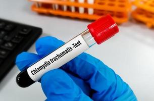 Blood sample with Chlamydia trachomatis test order. STD, STI photo