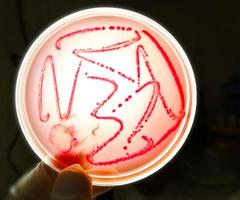 Bacteria colony on culture media plate, stool culture photo