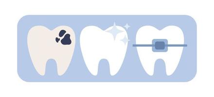 Dental icon. Teeth with problem and injuries, dental braces, cleaning. Private dentistry, orthodontic services, dental esthetic clinic. Vector flat illustration