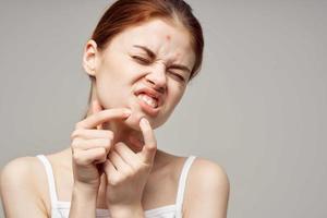 red-haired woman with pimples on the face hygiene isolated background photo